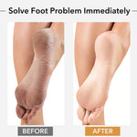 1PCS Professional Pedicure Rasp Tool for Dead Skin Crack Heels Beech Wood Foot File Rasp Callus Remover Foot Scrubber